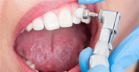 Eskişehir diş hastanesi diş taşı temizliği